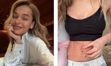 Анна Хилькевич продемонстрировала фигуру после третьих родов