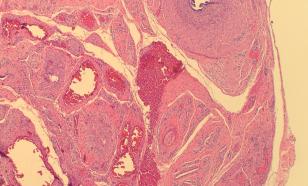 Иранские ученые назвали добавки, которые улучшают потенцию и качество спермы