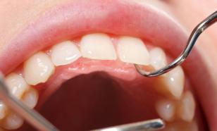 Гингивит без лечения грозит потерей зубов