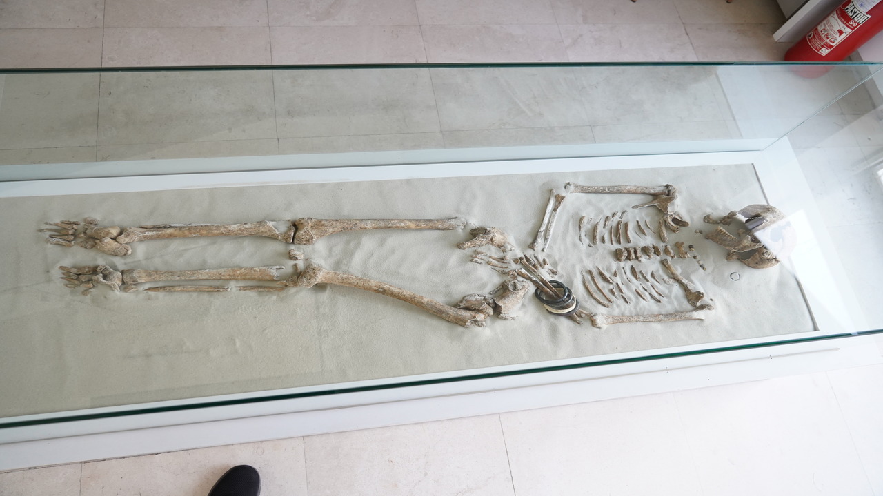 В Перми разработали систему для регенерации человеческих костей