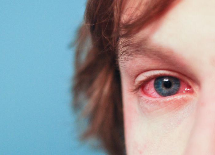 Названа причина возникновения "звездочек" при трении глаз руками