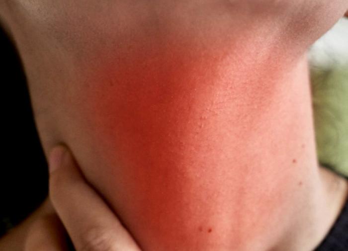 Врач рассказал, как самостоятельно выявить признаки рака ротовой полости