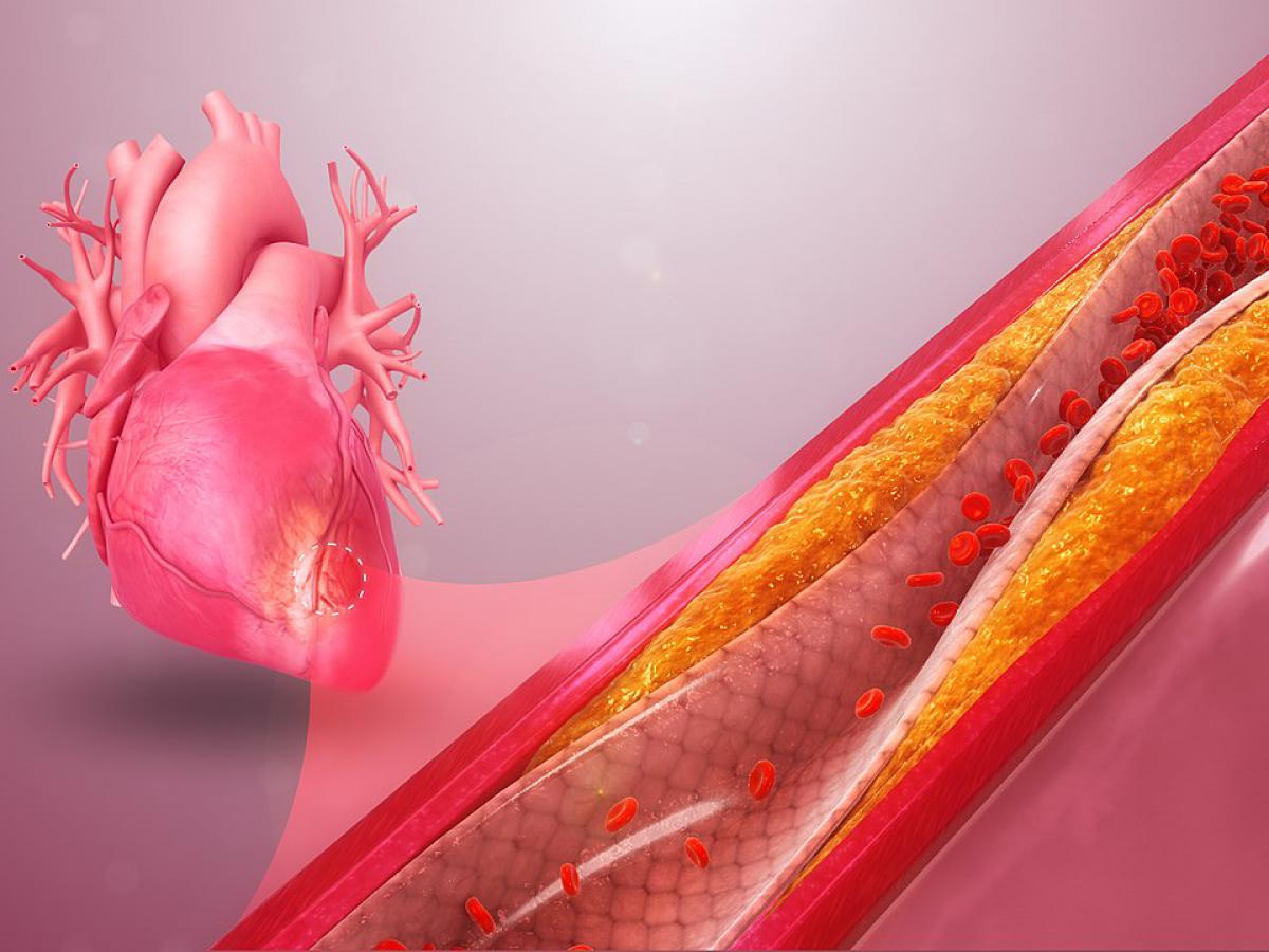 Новый этап в науке: сосуды из пробирки лечат болезни изнутри