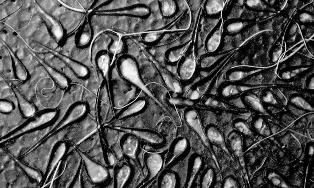 Японские ученые рассказали, как сперматозоиды преодолевают третий закон Ньютона