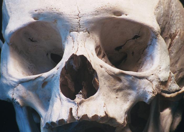 В Германии учёные выявили генетическую связь черепов, украденных из Африки, с живыми танзанийцами