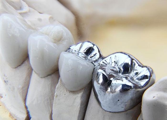 Российским ученым удалось улучшить сплав металла для медицинских протезов