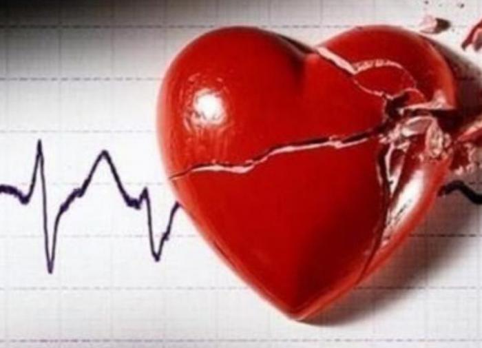 В США нашли новый подход к лечению инсульта