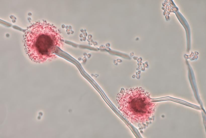 Микроскопическая фотография гриба Aspergillus