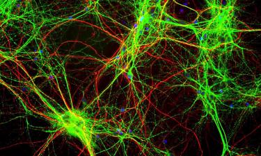Микроглия: архитекторы человеческого мозга, меняющие представления о его развитии