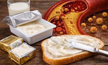 Плавленый сыр ускоряет старение сосудов из-за фосфатов — врач Вялов