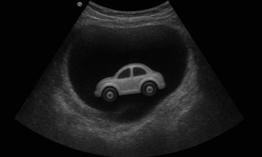 Врачи Центра Рошаля в Подмосковье извлекли машинку из желудка 5-летнего ребенка