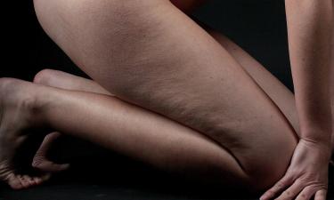 Целлюлит под контролем: лучшие кремы и обёртывания для домашнего ухода