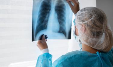 Спасает от рака и переломов, но вызывает страх сильнее диагноза: вся правда о луче, изменившем медицину