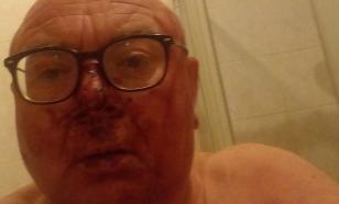 Журналиста Павла Лобкова избили в районе Патриарших в Москве