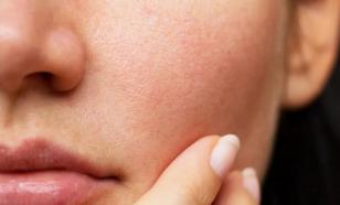 Расширенные поры