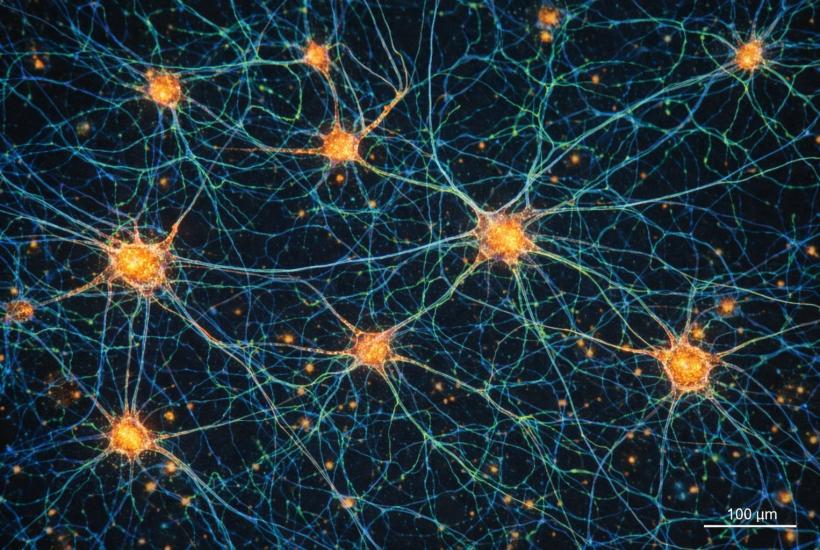 Нейроны мозга