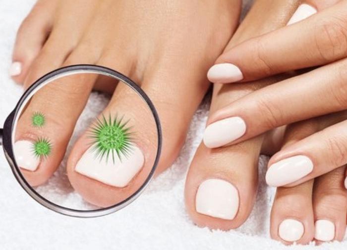 грибок на ногтях